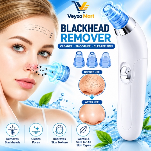 Derma Suction Blackheads Remover Device